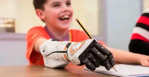 Протезы в Москве