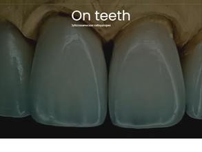 On teeth