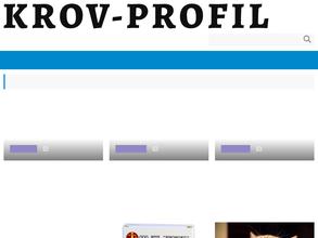 Профиль металл