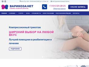 Варикоза нет