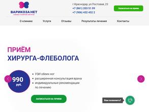 Варикоза нет