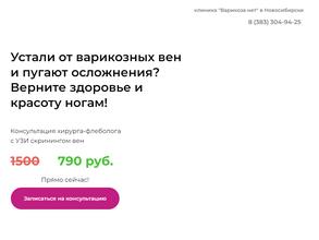 Варикоза нет