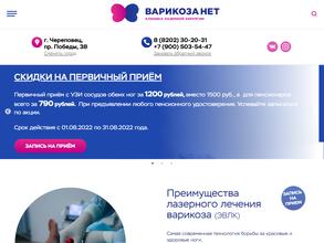 Варикоза Нет