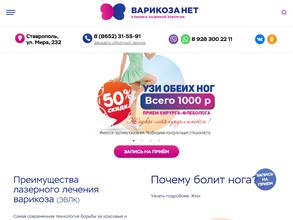 Варикоза НЕТ