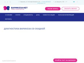 ВАРИКОЗА НЕТ