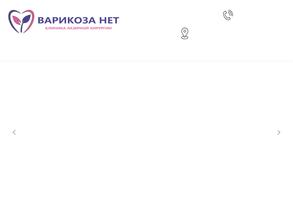 Варикоза нет