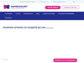 Варикоза нет