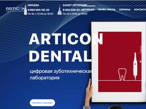 Articon dental