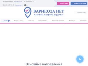 Варикоза нет