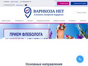 Варикоза нет