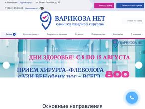 Варикоза нет