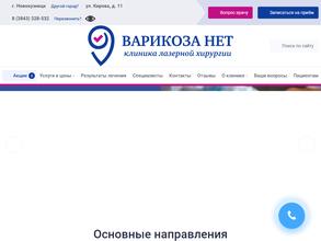 Варикоза нет