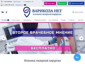 Варикоза нет