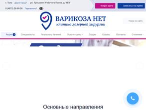 Варикоза нет