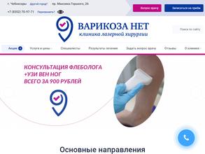 Варикоза нет