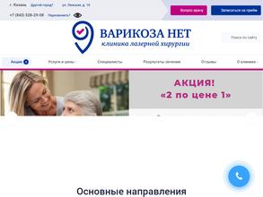 Варикоза нет