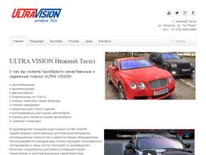 UltraVision+detailing