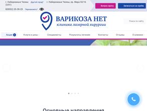 Варикоза нет