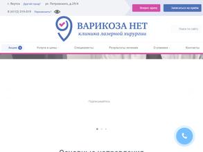 Варикоза нет