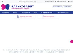 Варикоза нет