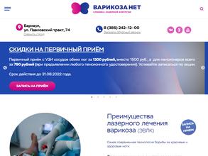 Варикоза нет