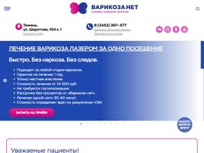 Варикоза нет