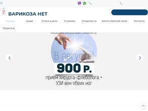 Варикоза нет