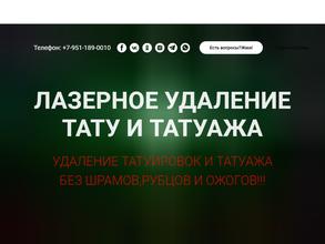 Студия по удалению татуировок