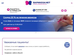 Варикоза нет