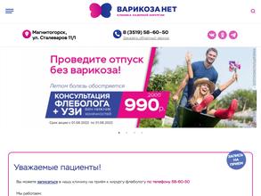 Варикоза нет